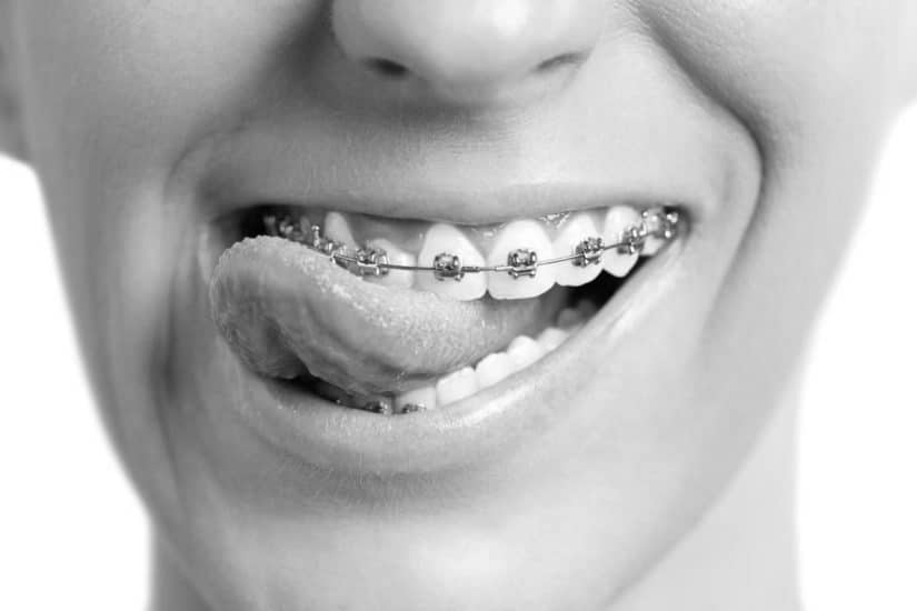 tandarts voor orthodontie